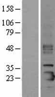 SFTPC / Surfactant Protein C (Over-Expression Lysate Myc-DDK (Flag))