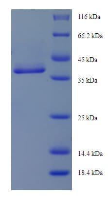 Human MAP3K7CL / TAK1L Protein (Recombinant His-SUMO)