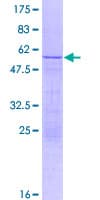 Human RPL14 / Ribosomal Protein L14 (Recombinant GST)