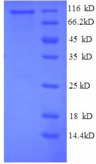 Human PYGL Protein (Recombinant His)