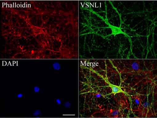 Monoclonal Mouse anti-Human VILIP / VSNL1 Antibody (clone UMAB116, aa2-191, IHC, IF, WB)
