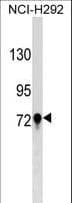TGM3 / Transglutaminase 3 Antibody (aa539-567)