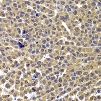 Polyclonal Rabbit anti-Human ARID3A / DRIL1 Antibody (IHC, WB)