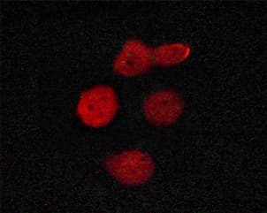 Polyclonal Rabbit anti-Human MED1 / TRAP220 Antibody (phospho-Thr1457, IHC, IF, WB)