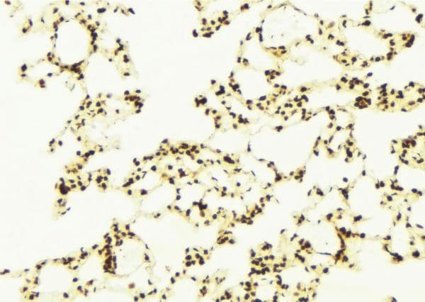 Polyclonal Rabbit anti-Human C9orf72 / ALSFTD Antibody (IHC, WB)