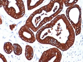 KRT19 / CK19 / Cytokeratin 19 Antibody (clone BA17, Ready-to-Use)