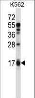 Polyclonal Rabbit anti-Human EDN2 / Endothelin 2 Antibody (aa107-136, WB)