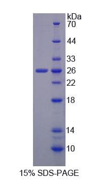Human DLG3 / SAP102 Protein (Recombinant His-S)