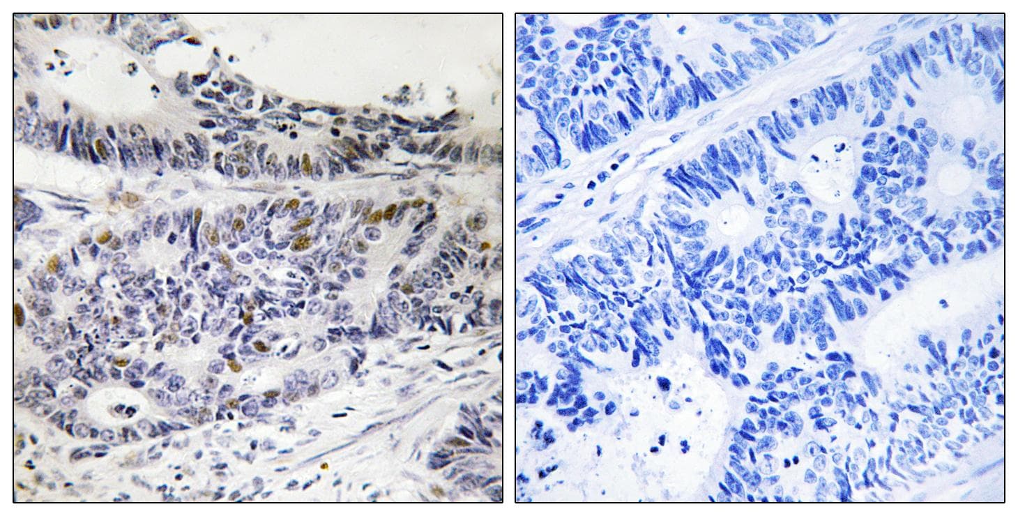 Polyclonal Rabbit anti-Human RB1 / Retinoblastoma / RB Antibody (phospho-Ser788, IHC)