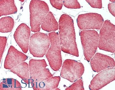 IHC-plus™ PPP1R3B Antibody