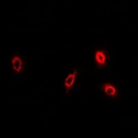Polyclonal Rabbit anti-Human PLA2G2D Antibody (IF, WB)