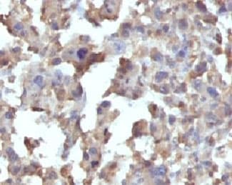 TNF Alpha Antibody (clone TNFA/1172)