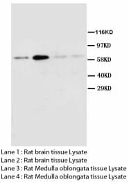 Polyclonal Rabbit anti-Human CHRM2 / M2 Antibody (Sepharose, aa451-466)