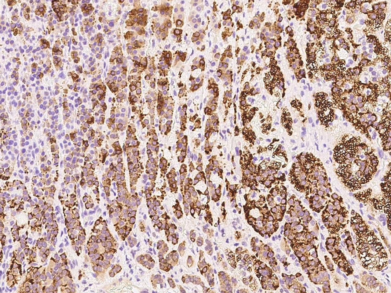 RASSF1 / RASSF1A Antibody