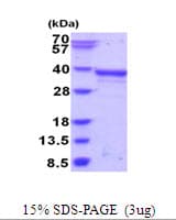 Human PAX8 Protein (Recombinant His)