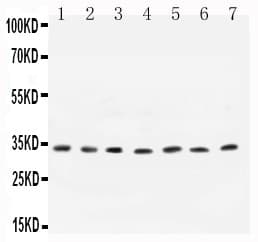 CCND1 / Cyclin D1 Antibody (aa19-37)