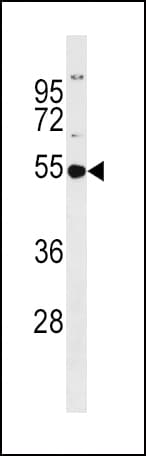 GSS / Glutathione Synthetase Antibody (aa372-400)