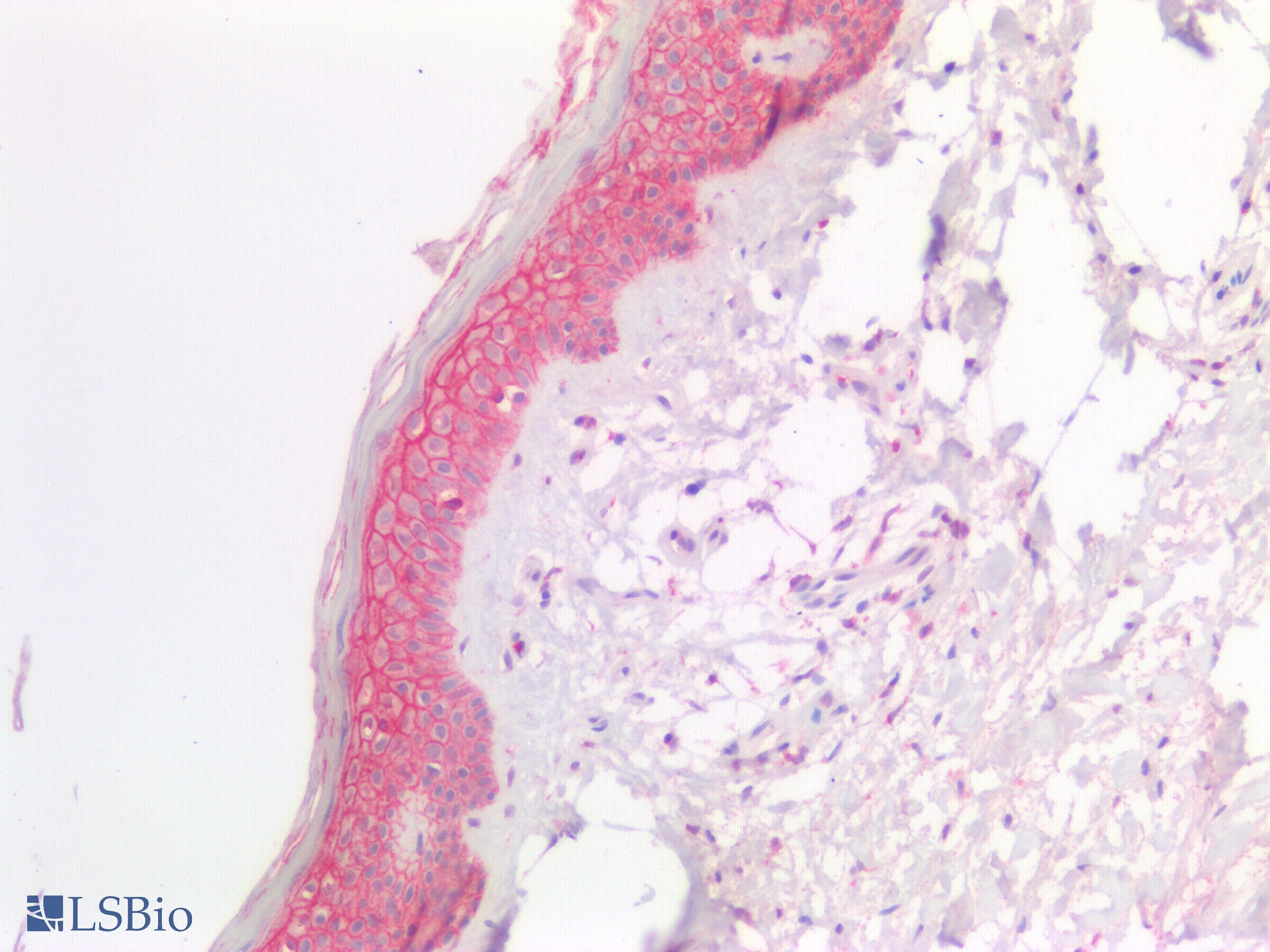 PathPlus™ SDC1 / Syndecan 1 / CD138 Antibody