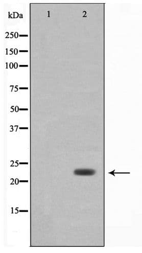 LDOC1L Antibody