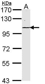LAMC2 / Laminin Gamma 2 Antibody (aa445-657)