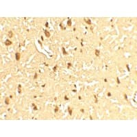 IHC-plus™ Polyclonal Rabbit anti-Human SAMHD1 Antibody (IHC, IF, WB)