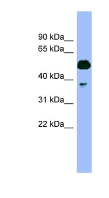 Polyclonal Rabbit anti-Human PSMC4 Antibody (N-Terminus, WB)