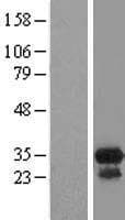 CCDC117 Protein (Over-Expression Lysate Myc-DDK (Flag))