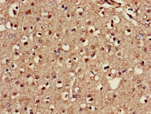 Polyclonal Rabbit anti-Human NOS1AP / CAPON Antibody (IHC, IF)