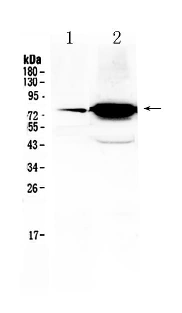 Polyclonal Rabbit anti-Human FSH Receptor / FSHR Antibody (WB)