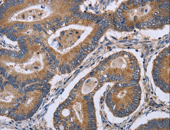 GABPB2 Antibody