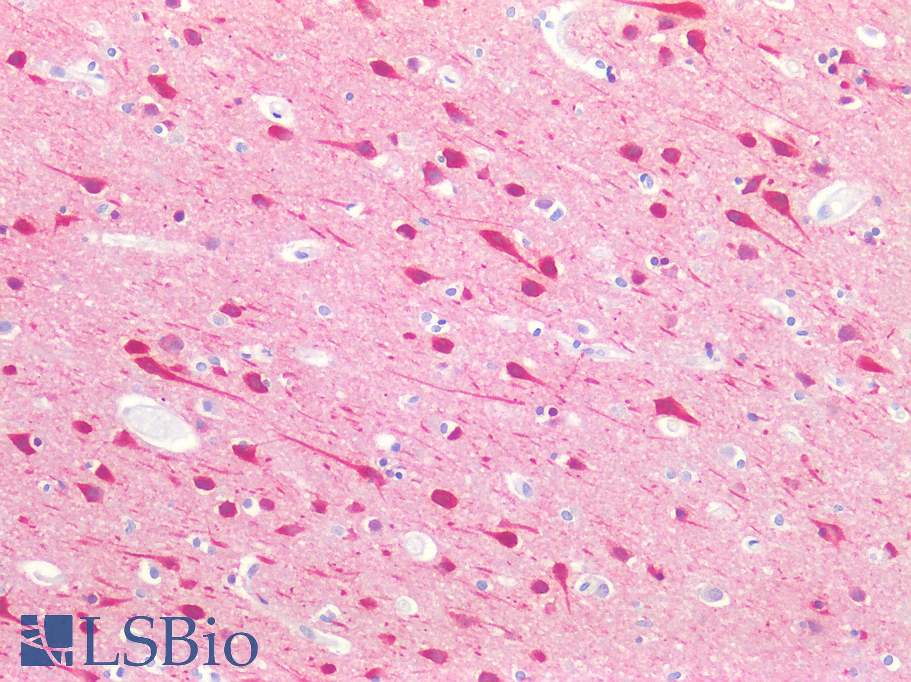 IHC-plus™ Polyclonal Rabbit anti-Human MAPT / Tau Antibody (pT548, IHC, WB)