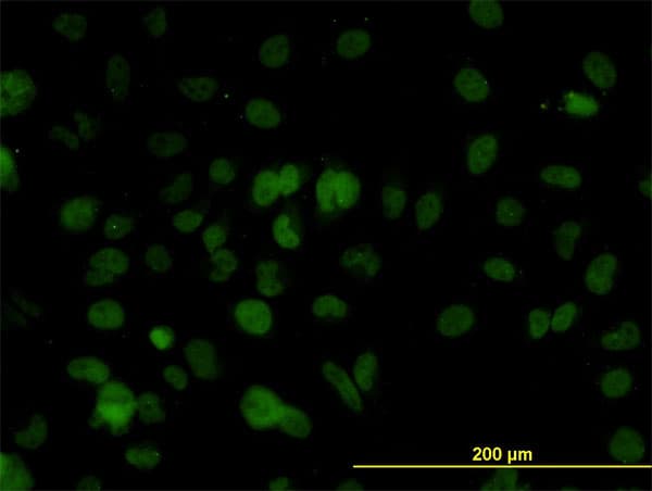 IHC-plus™ Monoclonal Mouse anti-Human BAF60B / SMARCD2 Antibody (clone 2F7, IHC, IF, WB)