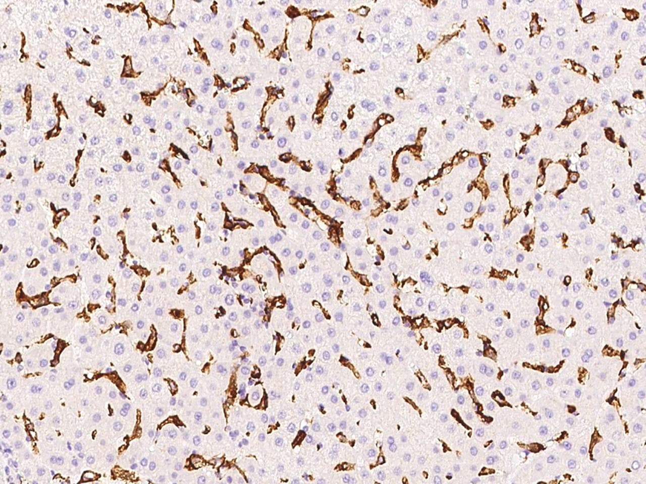 Polyclonal Rabbit anti-Human FCGR3A / CD16A Antibody (Preservative Free, IHC)