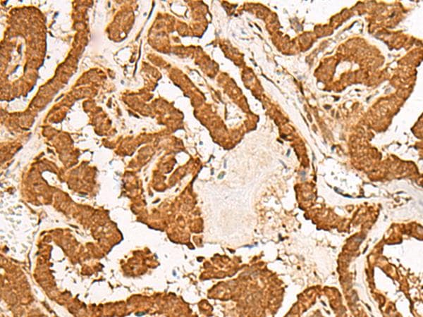 Polyclonal Rabbit anti-Human GMEB2 Antibody (IHC)