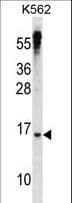 Polyclonal Rabbit anti-Human MXD3 / MAD3 Antibody (aa28-56, WB)