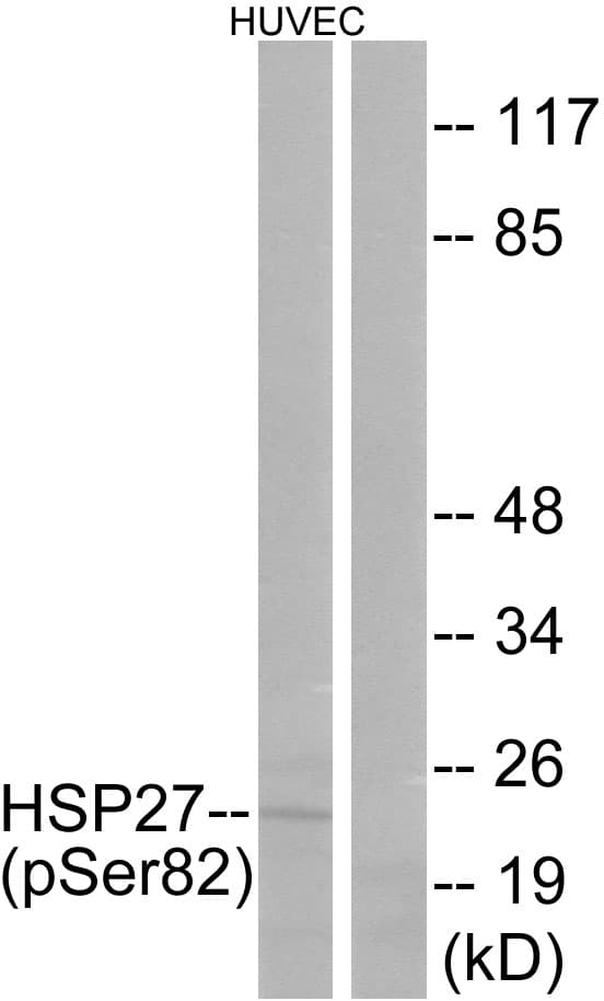 HSPB1 / HSP27 Antibody (phospho-Ser82)