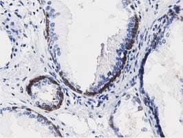 ALDH1L1 Antibody (clone OTI3D2)