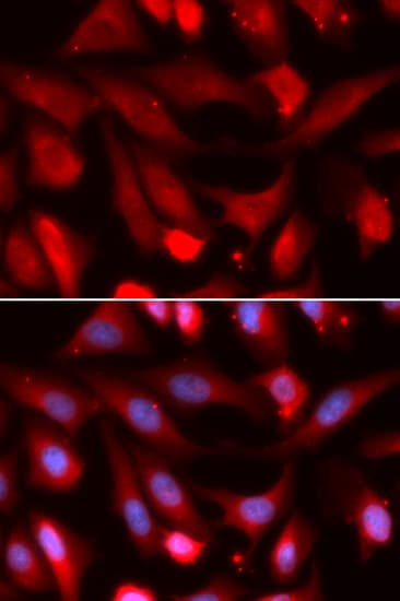 Polyclonal Rabbit anti-Human SMAD4 Antibody (IHC, IF, WB)