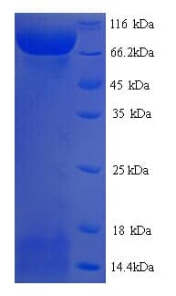 Mouse LOXL2 Protein (Recombinant His)