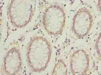 COMMD2 Antibody