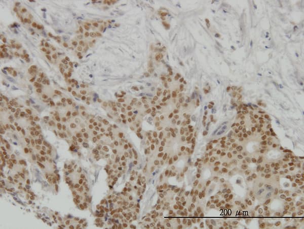 Monoclonal Mouse anti-Human PR / Progesterone Receptor Antibody (clone 4E9, IHC, IF, WB)