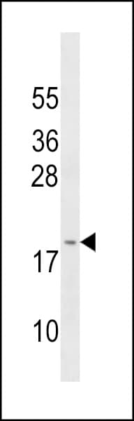 GAGE3 Antibody (aa1-30)