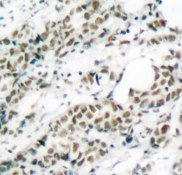 Polyclonal Rabbit anti-Human FOXO4 / AFX1 Antibody (phospho-Ser197, IHC, IF, WB)