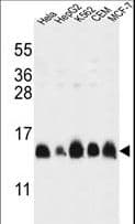 HIST1H2AL Antibody (aa103-130)