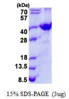 Human SFRP-3 / FRZB Protein (Recombinant His)