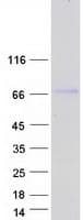 Human ABLIM2 Protein (Recombinant Myc-DDK (Flag))