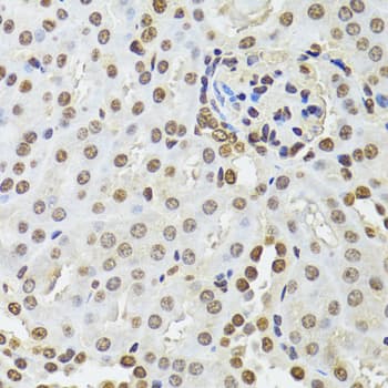 CDX2 Antibody