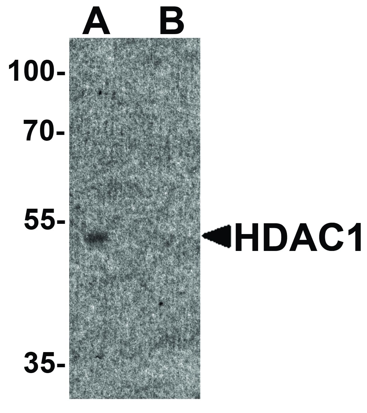 Polyclonal Rabbit anti-Human HDAC1 Antibody (WB)