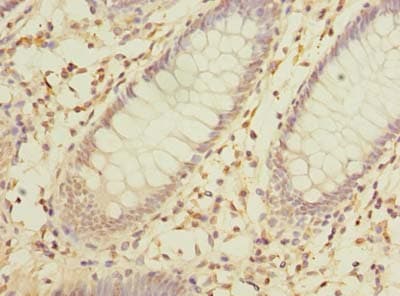 MRPL16 Antibody