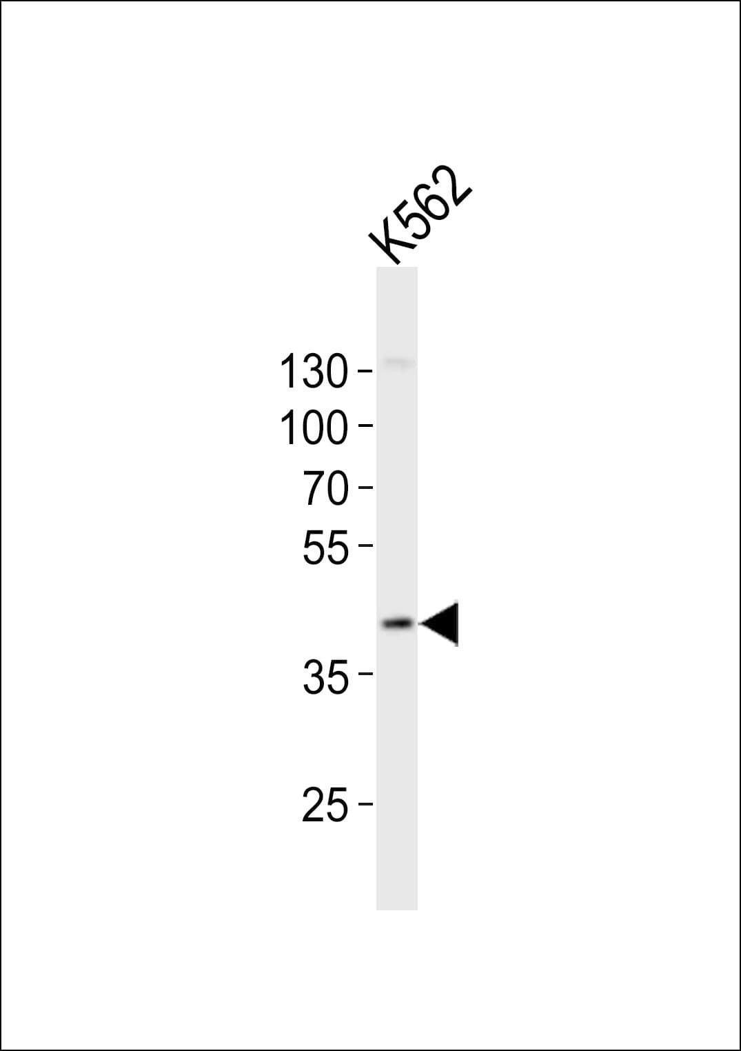 CHST11 Antibody (aa246-280)